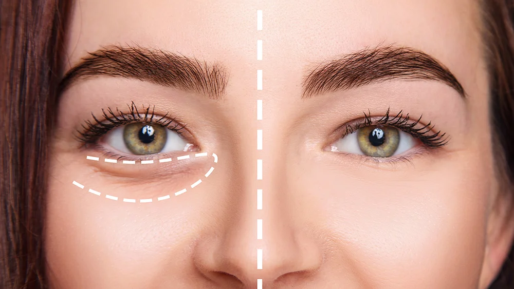 Under Eye Light Filler