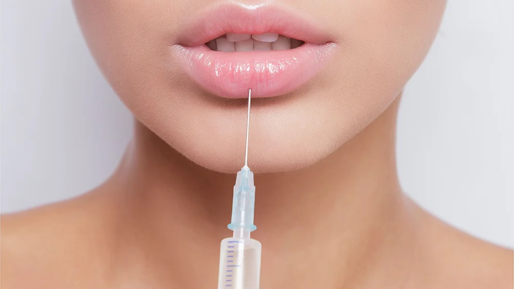 Lip Filler